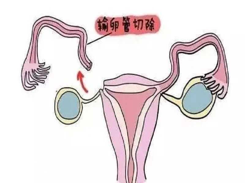 2023南京妇幼保健院三代供卵试管婴儿费用一览，附供卵试管医院排名