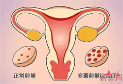 上海借腹生子代怀，孕妇能不能吃白木耳