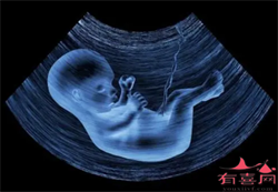 郑州代孕机构是传销吗,郑州三代试管代孕儿童医院排名？试管婴儿-ET机构列表